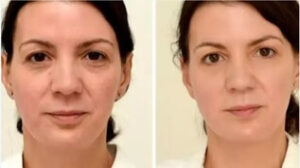 אישה - פנים לפני ואחרי